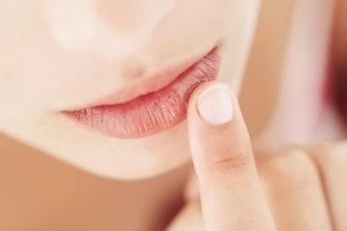 Как вылечить потрескавшиеся губы